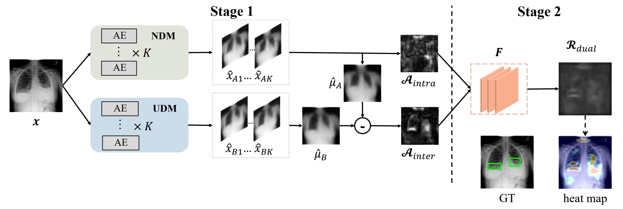 Dual-distribution discrepancy with self-supervised refinement for anomaly detection in medical images