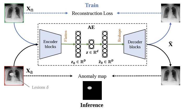 Rethinking Autoencoders for Medical Anomaly Detection from A Theoretical Perspective